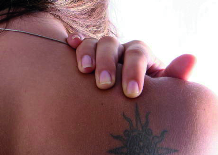 tatoo_laser tatoo_laser
