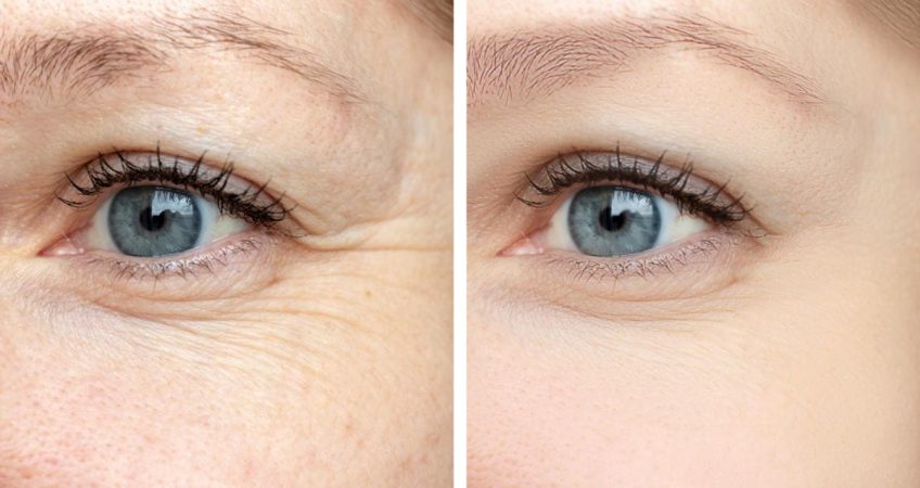 Beauty-Tipps für strahlende Augen