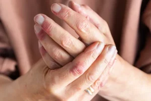 Psoriasis arthritis schmerzhafte Gelenksbeteiligung an allen Gelenken möglich