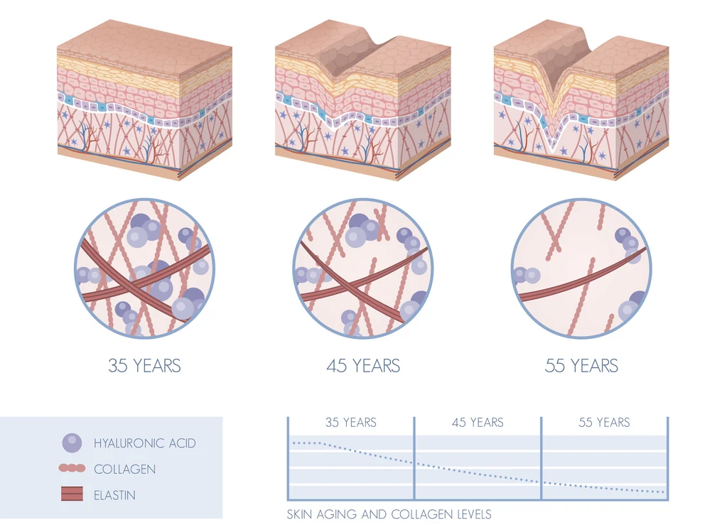 Die Hautspannung im Altersvergleich