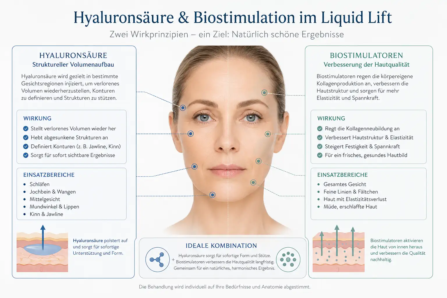 Vergleich von Hyaluronsäure und Biostimulatoren beim modernen Liquid Lift